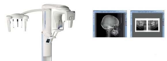 tl_files/images/Tehnologije/ProMax3.jpg tl_files/images/Tehnologije/ProMax3.jpg
