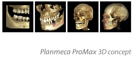 tl_files/images/Tehnologije/ProMax3D_concept_1.jpg tl_files/images/Tehnologije/ProMax3D_concept_1.jpg